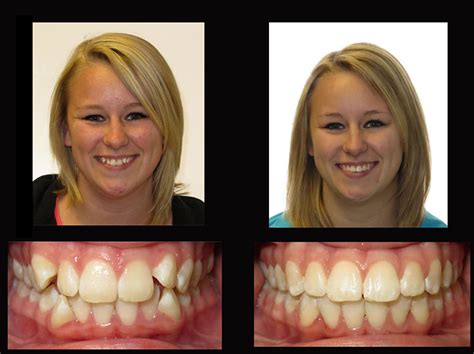 Arrowhead orthodontics - 